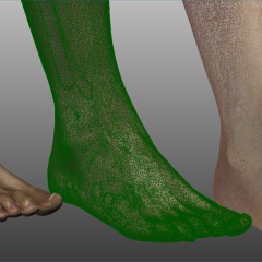Orthopedics and medical